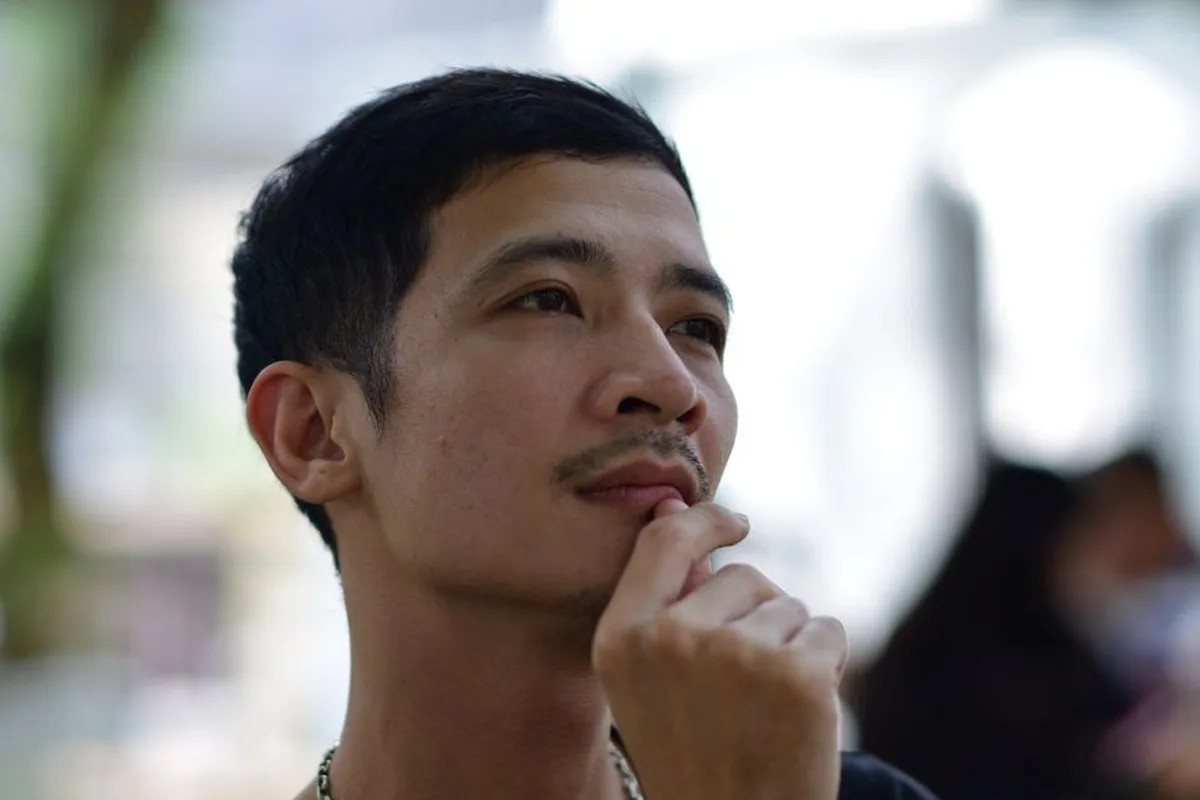 Nam giới có nên cắt mí không? Cắt mí nam khác nữ thế nào?