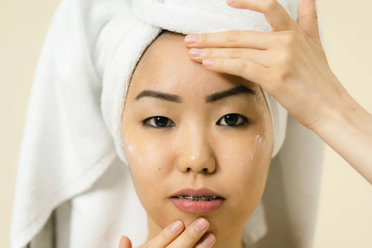 Peel da hoá học có trị được sẹo rỗ không? Hợp loại sẹo nào?