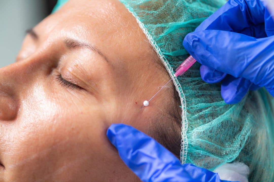 Botox và Filler: khi nào nên dùng cái nào? Bác sỹ BonBoz giải thích