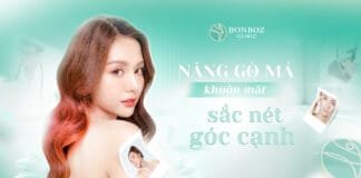 Nâng gò má: Khuôn mặt sắc nét, góc cạnh