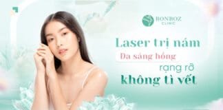 Laser trị nám: Da sáng hồng, rạng rỡ, không tì vết