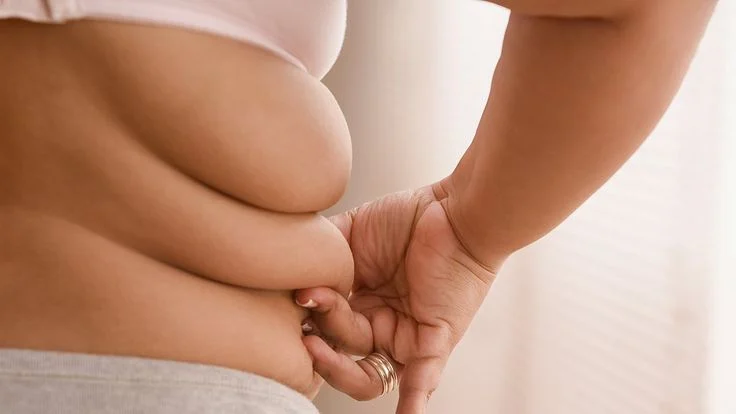 5 TÁC HẠI NGHIÊM TRỌNG CỦA BÉO PHÌ KHIẾN CƠ THỂ "KÊU CỨU" - ĐỪNG CHỦ QUAN! 8 Người bị béo phì gặp rất nhiều phiền phức với thể trọng và dáng người quá cỡ.